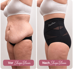 ShapeBloom™ 360° Shape-Slip